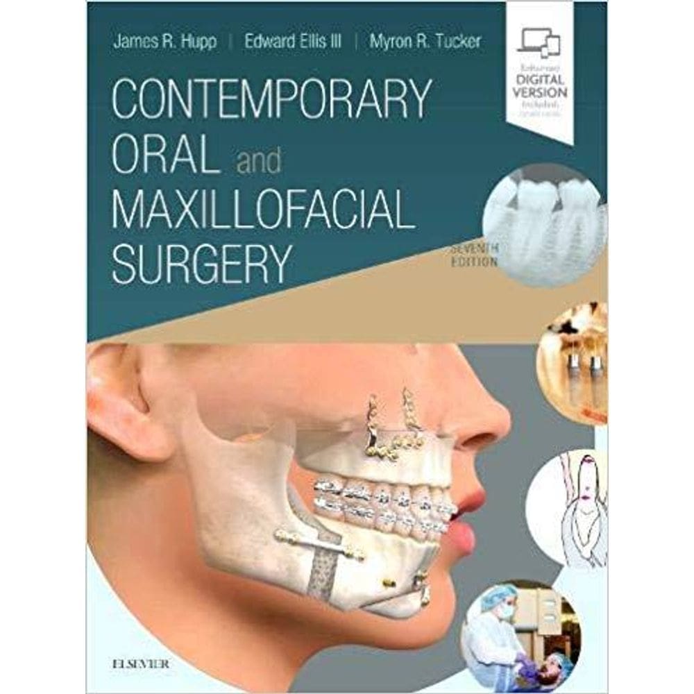 Contemporary Oral and Maxillofacial Surgery