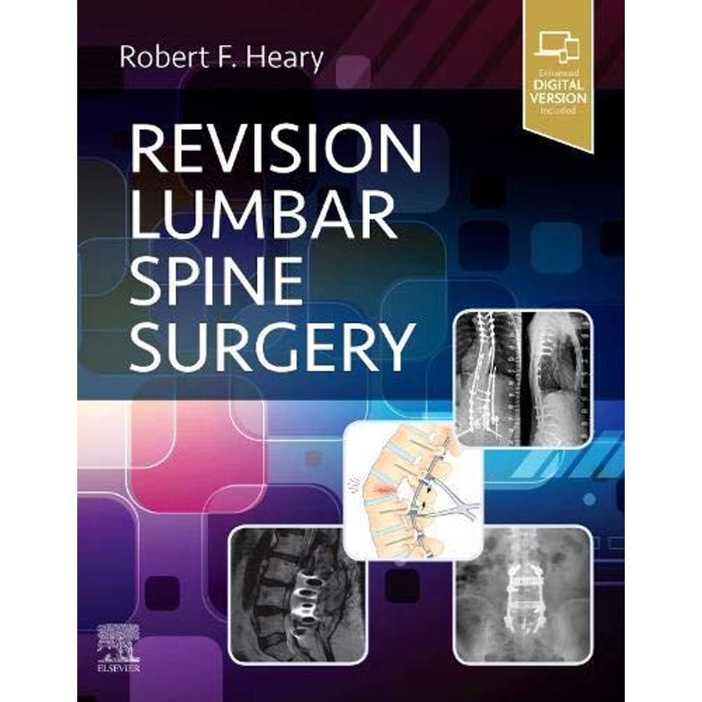 Revision Lumbar Spine Surgery