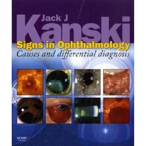 Signs In Ophthalmology - Causes And Differential Diagnosis - Expert Consult
