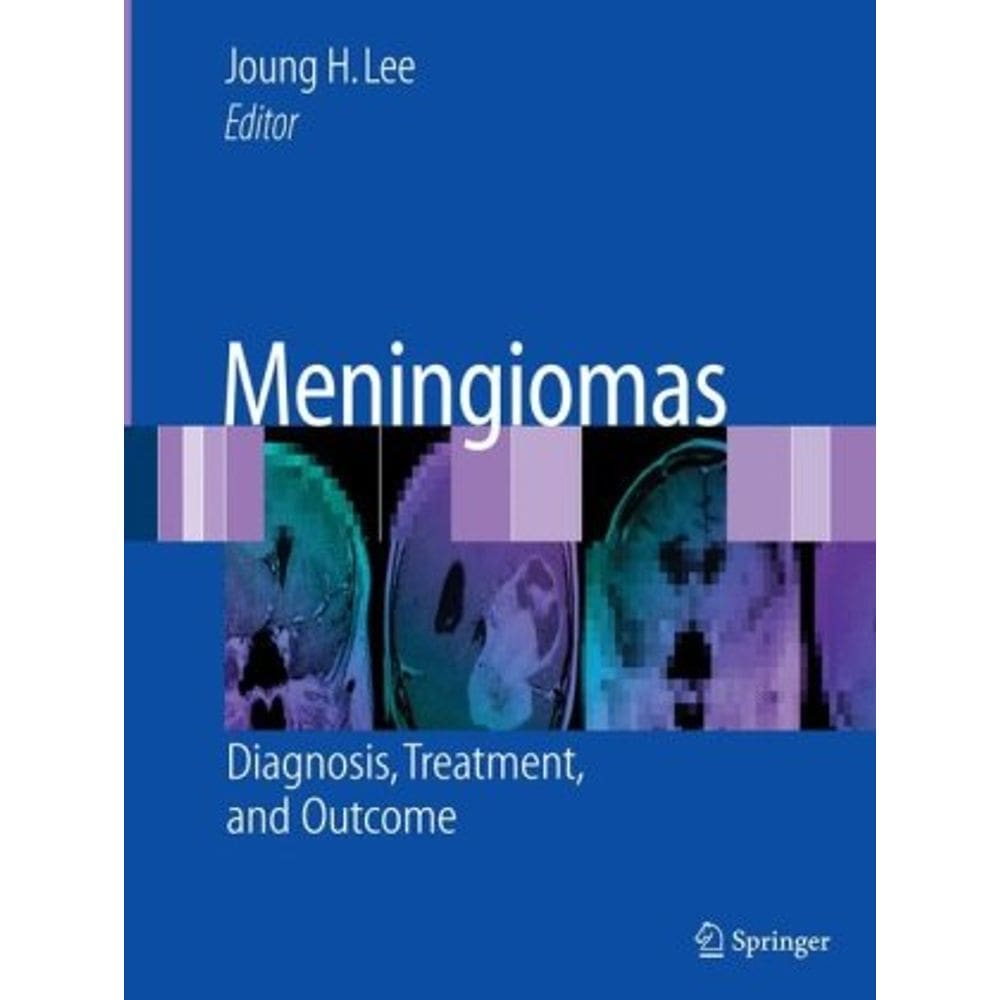 Meningiomas Diagnosis And Treatment