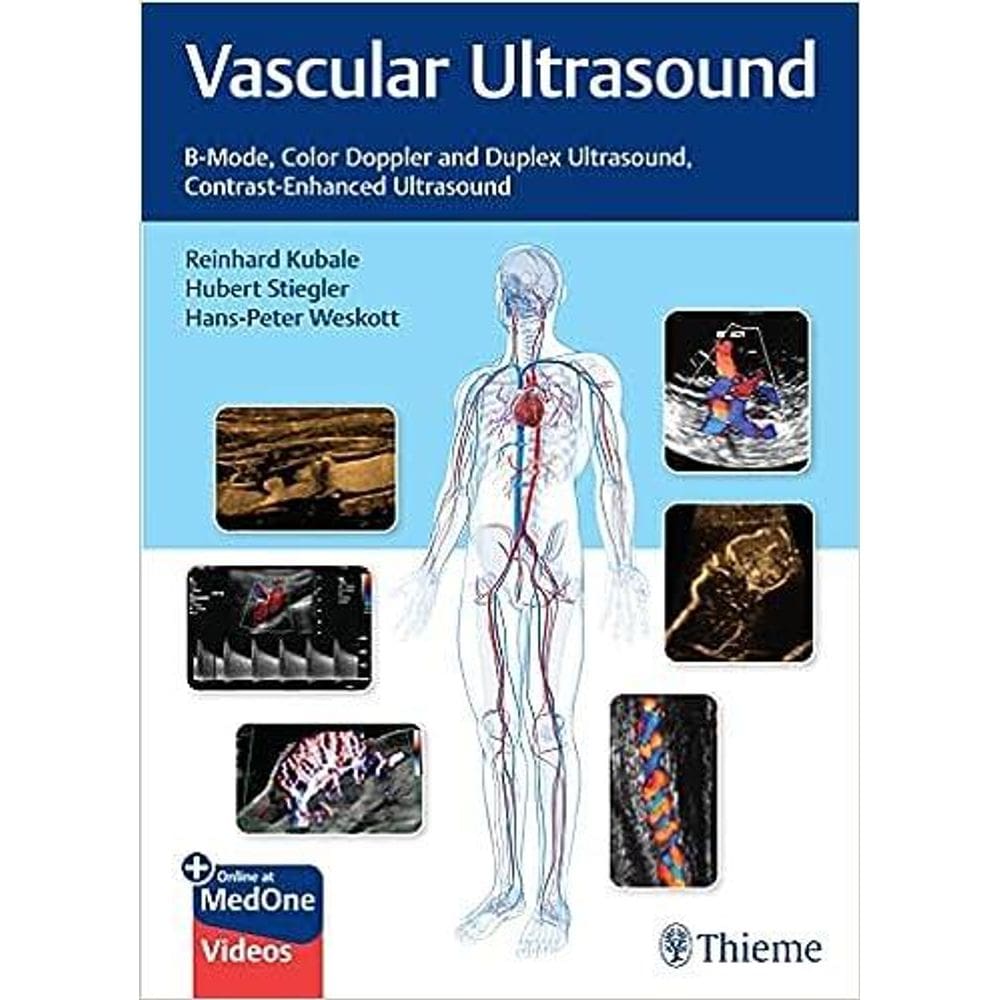 Vascular Ultrasound