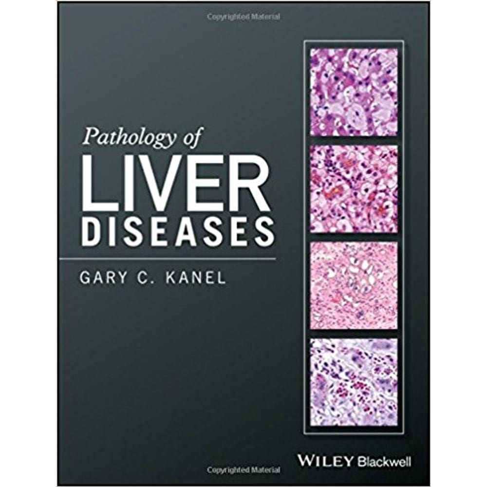 Pathology Of Liver Diseases