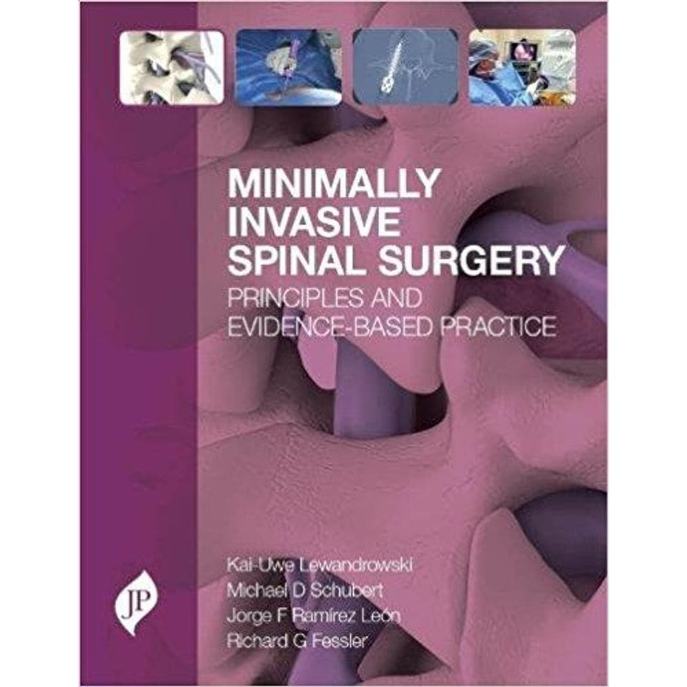 Minimally Invasive Spinal Surgery