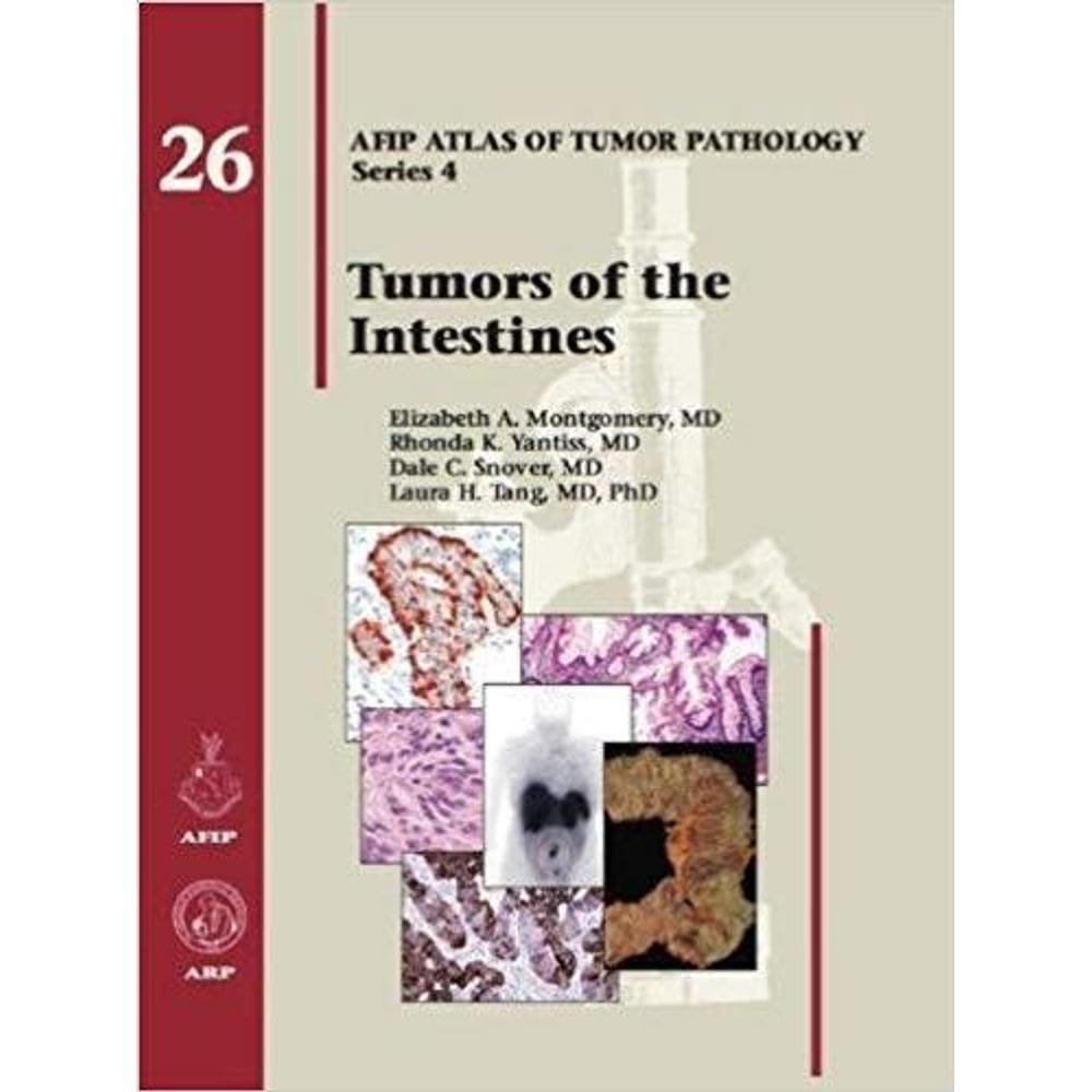 Tumors Of The Intestines (Atlas Of Tumor Pathology Series 4)