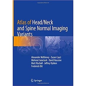 Atlas Of Head Neck And Spine Normal Imaging Variants