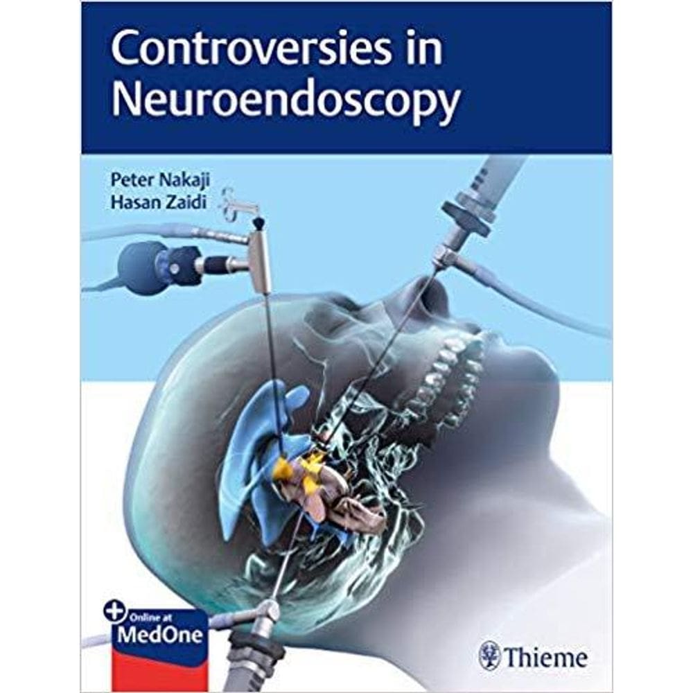 Controversies In Neuroendoscopy