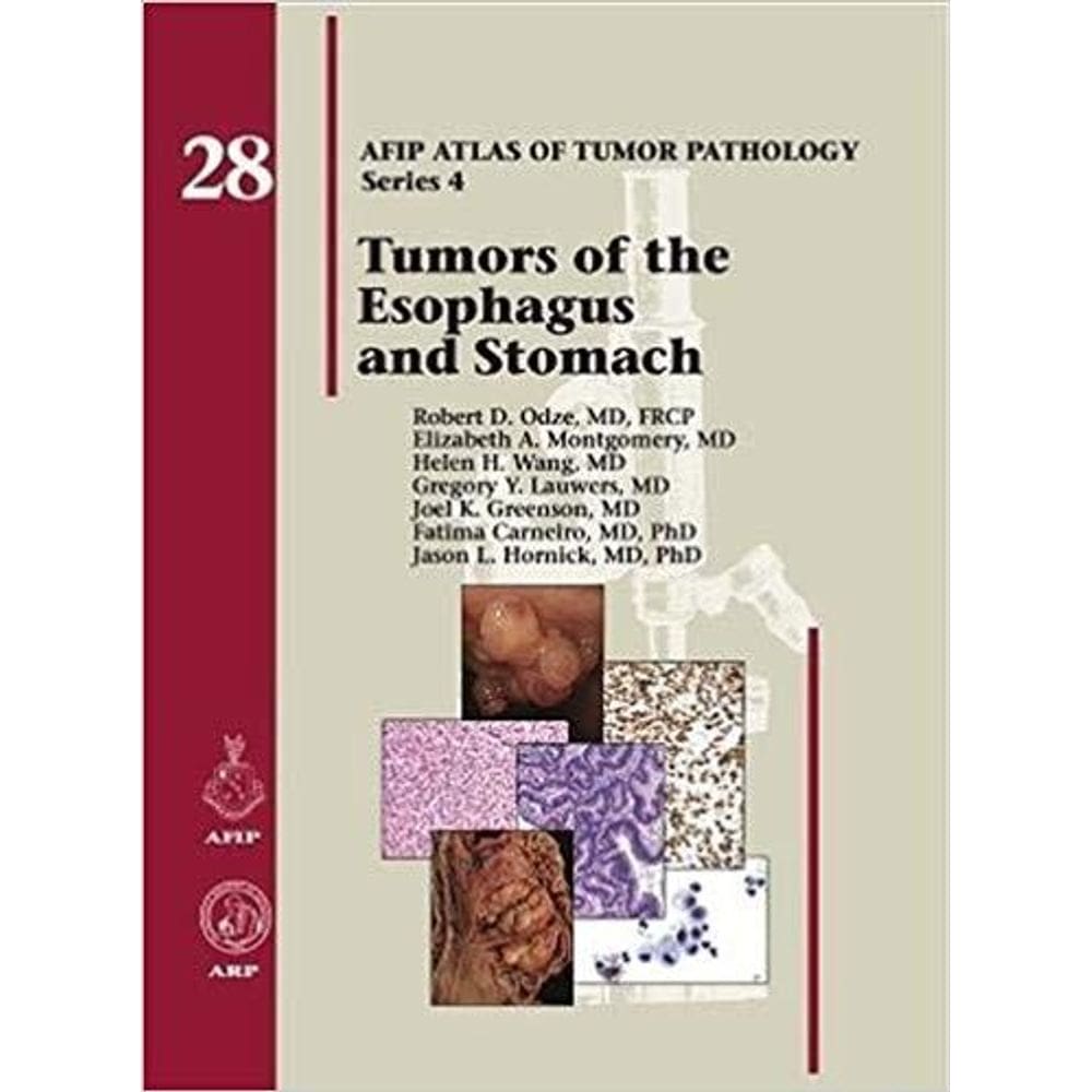 Tumors Of The Esophagus And Stomach