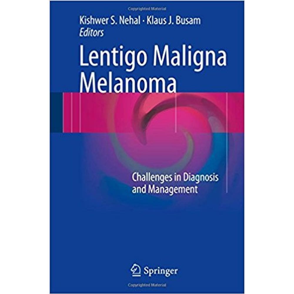 Lentigo Maligna Melanoma