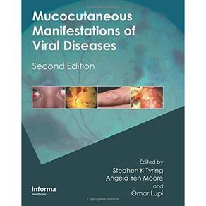 Mucocutaneous Manifestations Of Viral Diseases