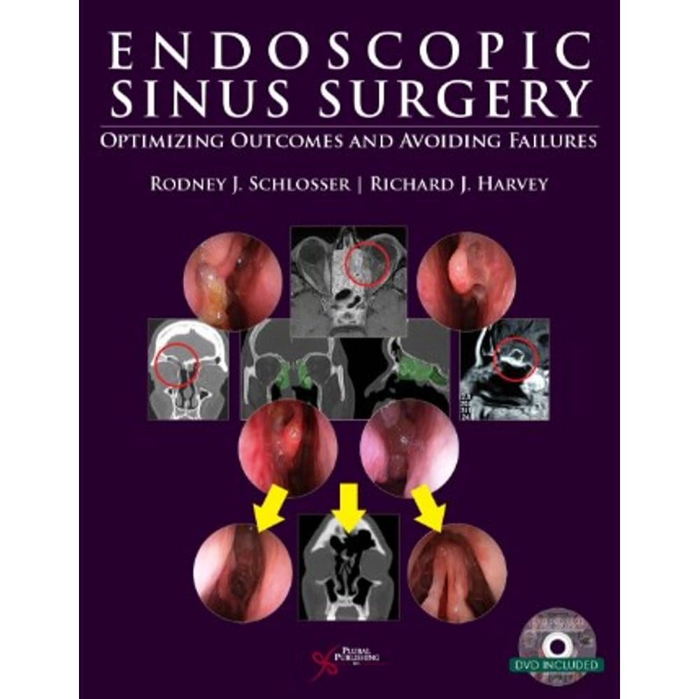 Endoscopic Sinus Sugery
