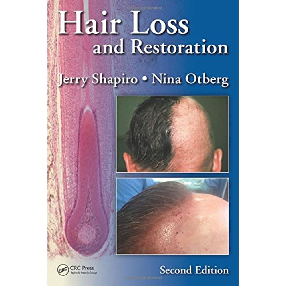 Hair Loss And Restoration