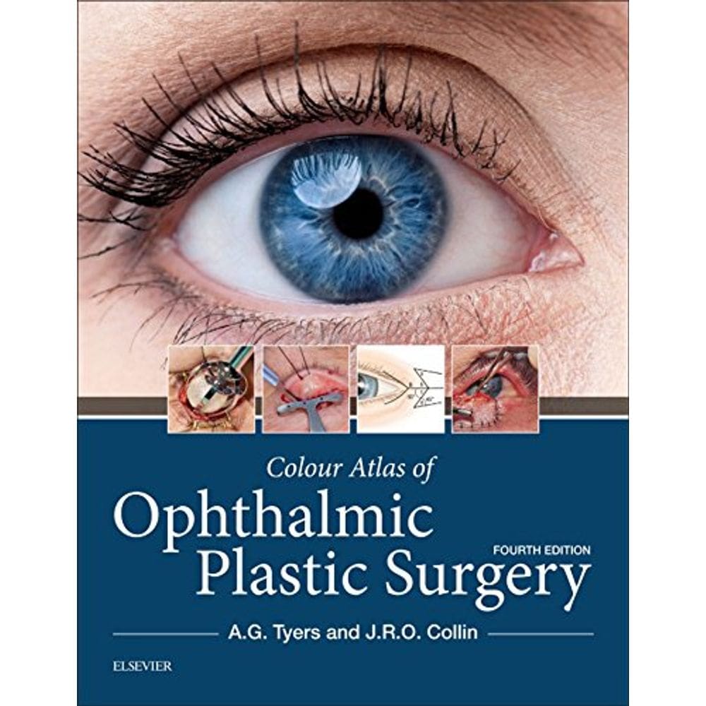 Colour Atlas of Ophthalmic Plastic Surgery