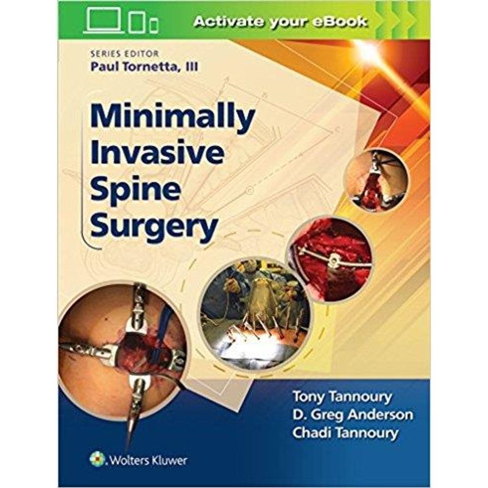 Minimally Invasive Spine Surgery