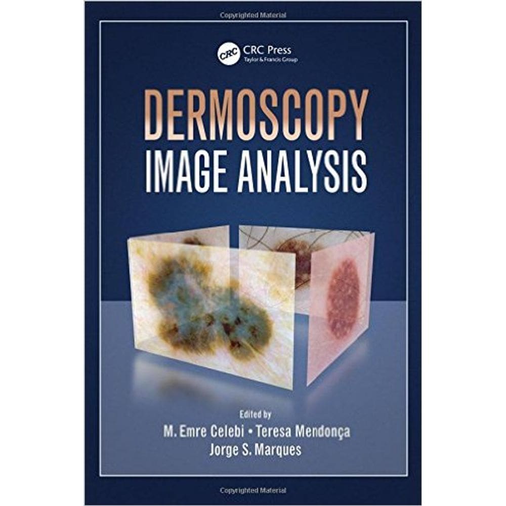 Dermoscopy Image Analysis
