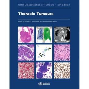 Thoracic Tumours Who Classification Of Tumours