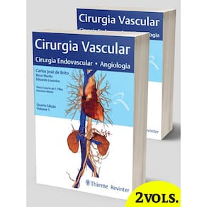Cirurgia Vascular Cirurgia Endovascular Angiologia 2 Vols