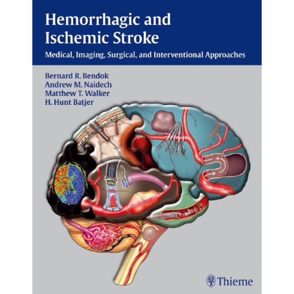Hemorrhagic And Ischemic Stroke