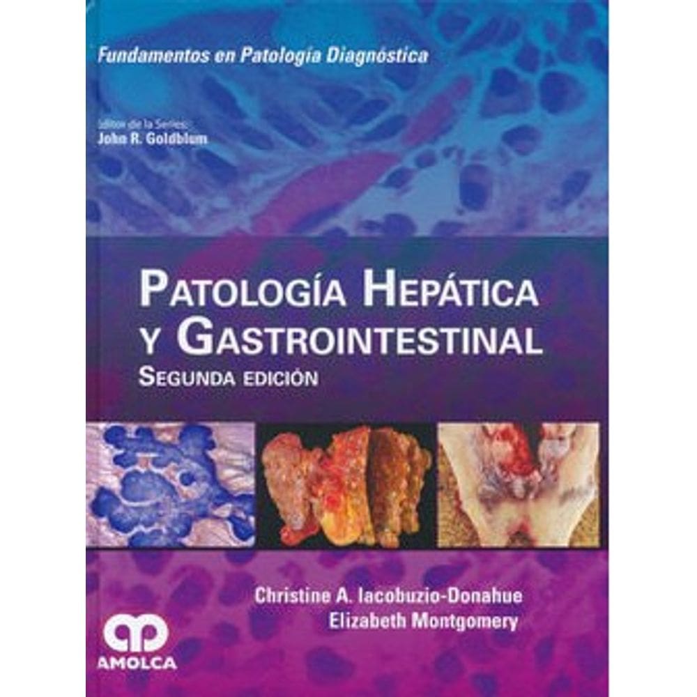 Patologia Hepatica Y Gastrointestinal