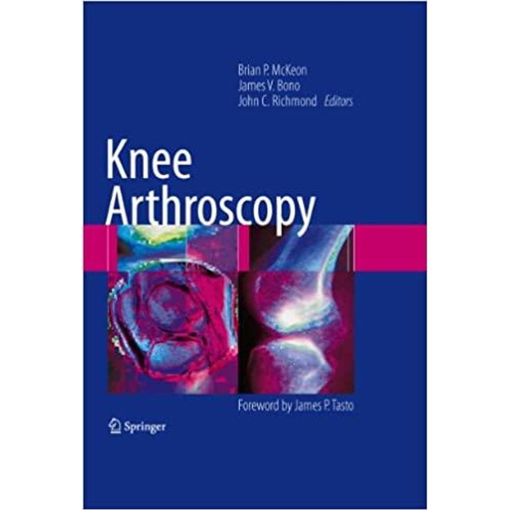 Knee Arthroscopy