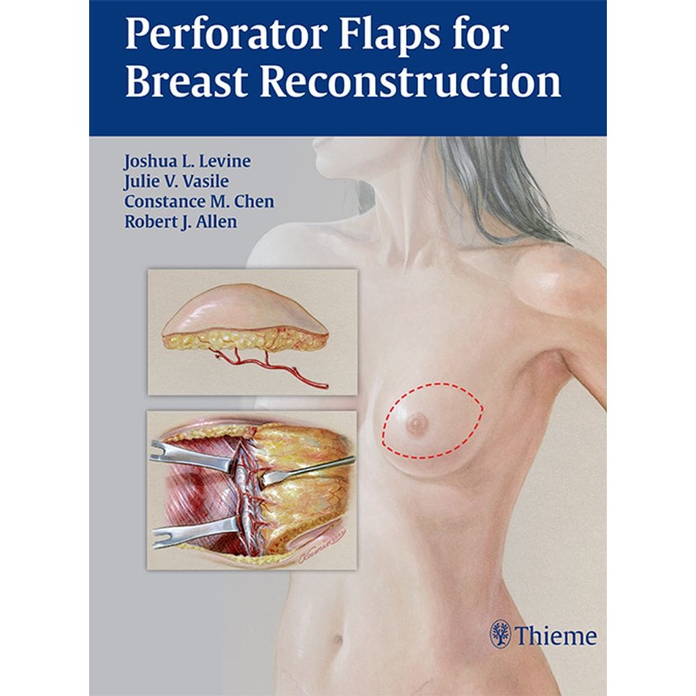 Perforator Flaps For Breast Reconstruction