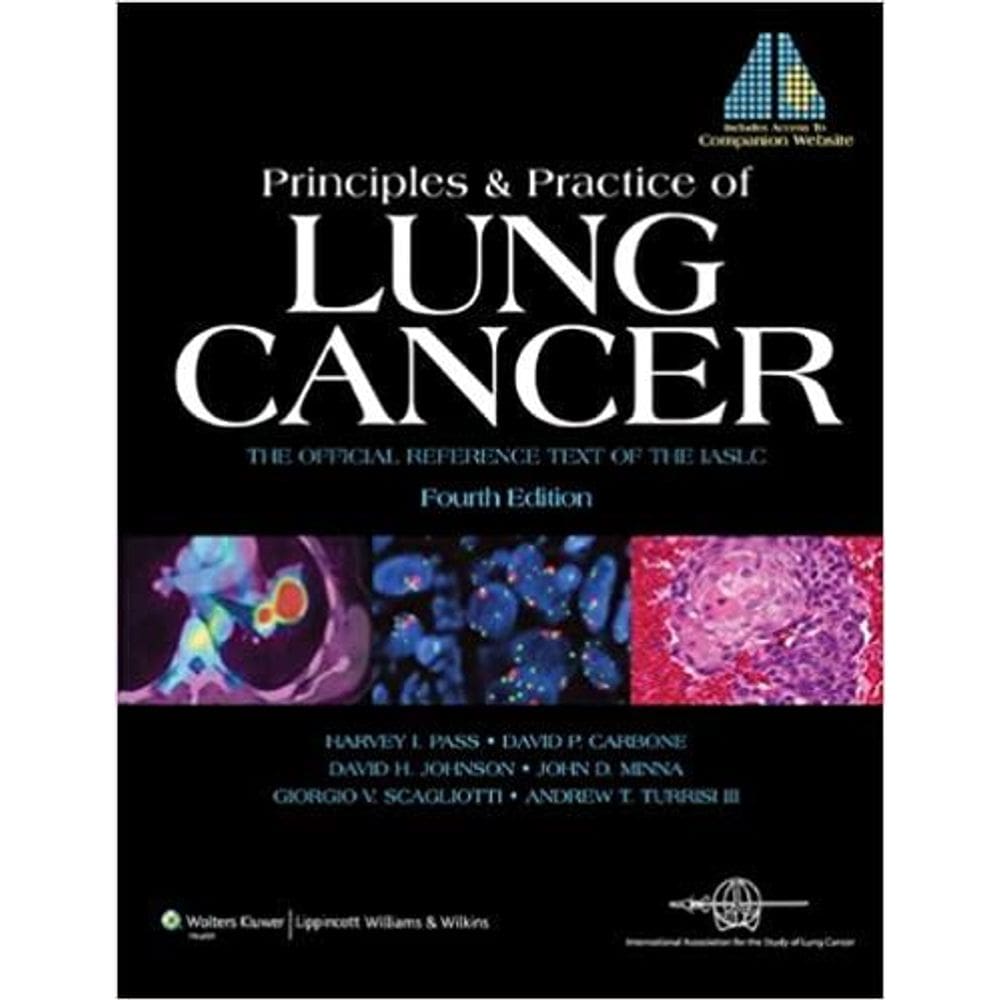 Principles And Practice Of Lung Cancer