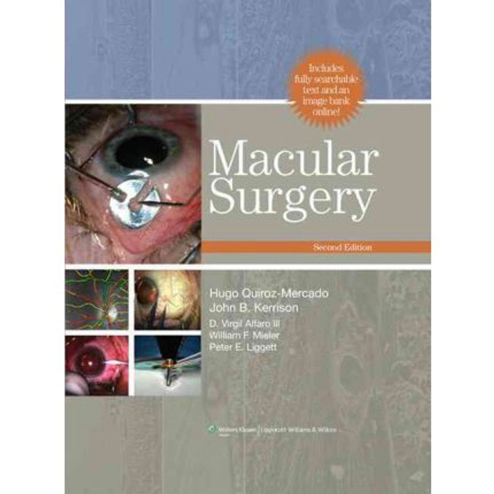 Macular Surgery