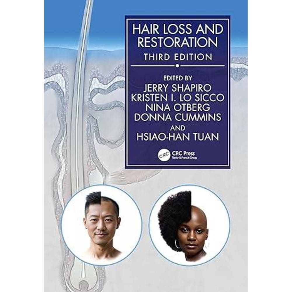 Hair Loss And Restoration