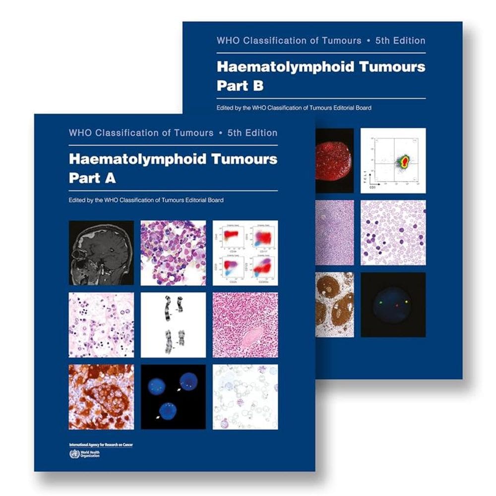 Haematolymphoid Tumours