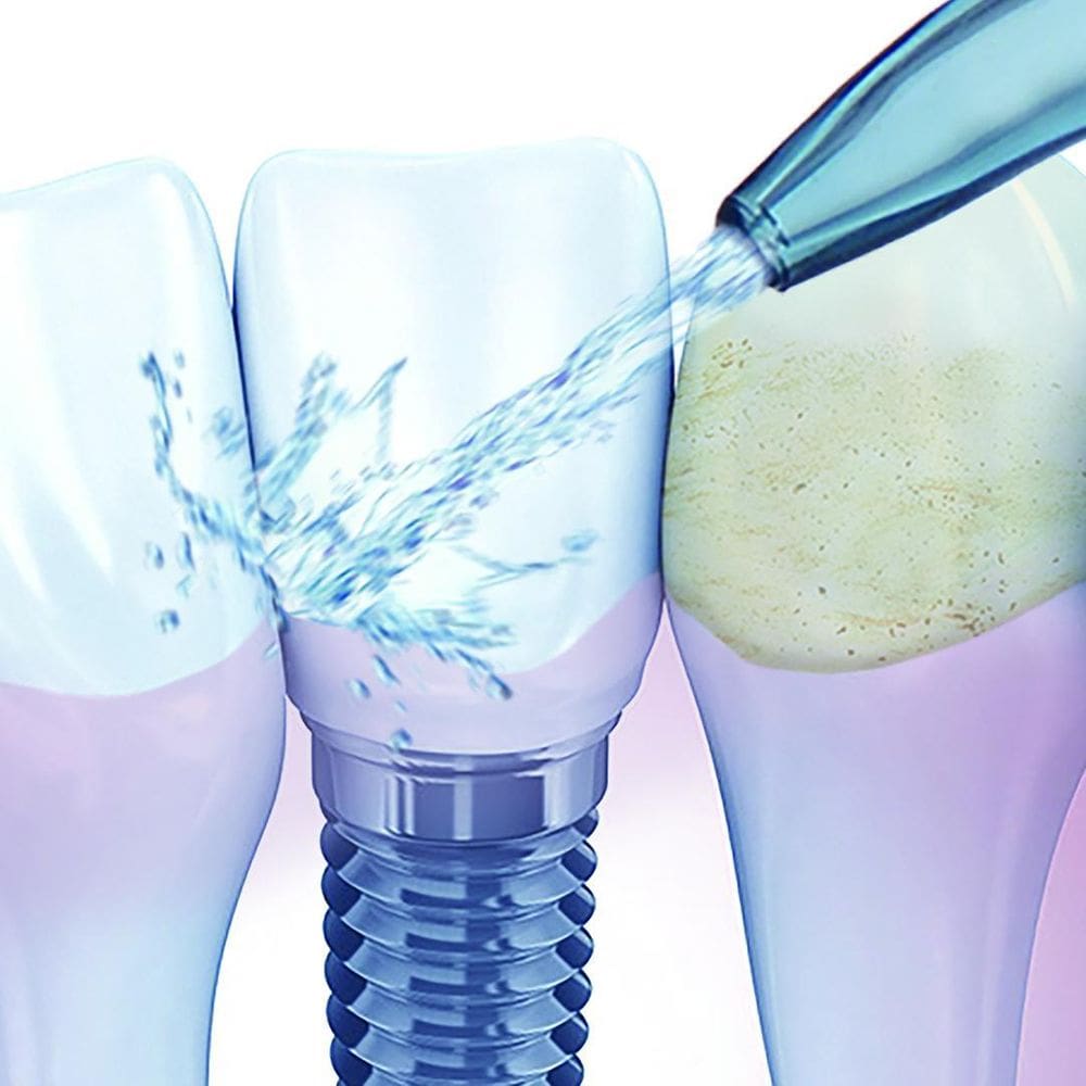 Irrigador Dental Veitsmile Water Jet