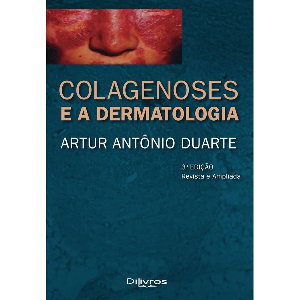 Livro Colagenoses E A Dermatologia