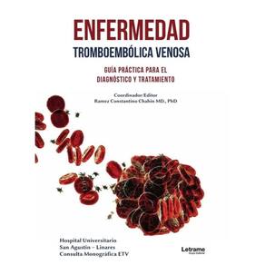 Enfermedad tromboembólica venosa - Espanhol