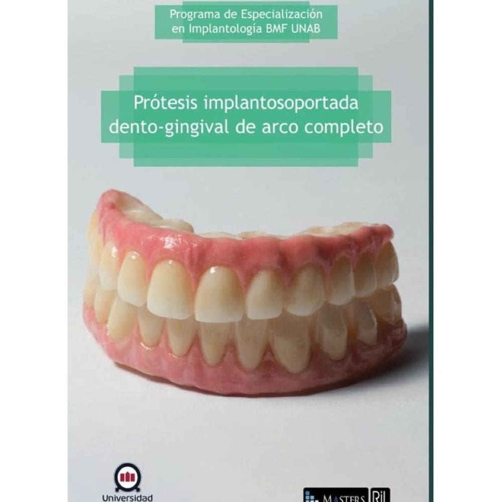 Prótesis implantosoportada dento-gingival de arco completo - Espanhol