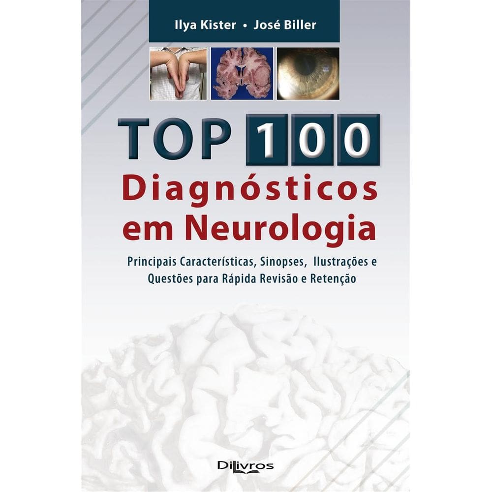 Top 100 Diagnostico em Neurologia