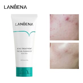 Leite de limpeza de acne oligopeptídeo LANBENA