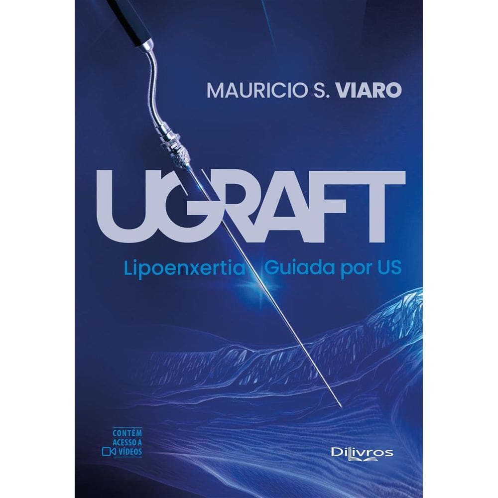 Ugraft Lipoenxertia Guiada Por Us