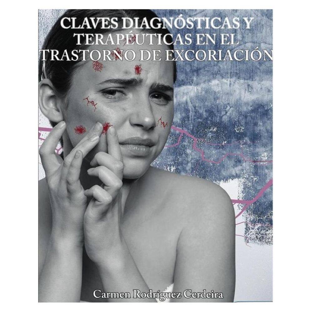 Claves diagnósticas y terapéuticas en el trastorno de excoriación - Espanhol