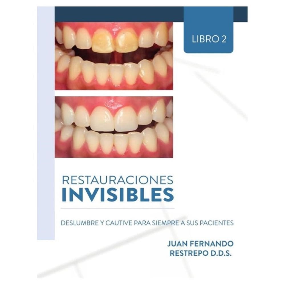 Restauraciones Invisibles: Deslumbre Y Cautive Para Siempre A Sus Pacientes - Espanhol
