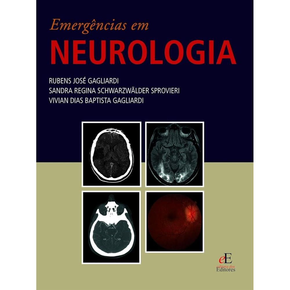 Emergencias Em Neurologia