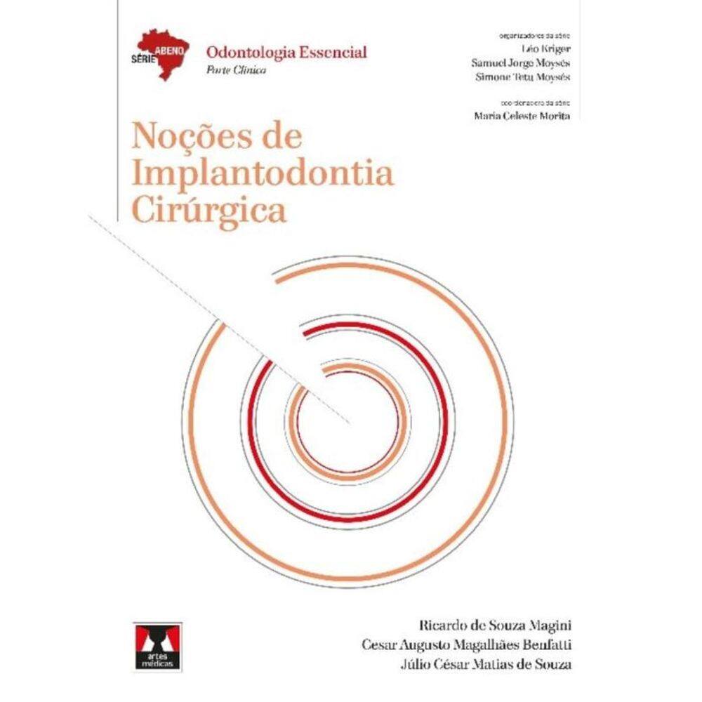 Abeno - Nocoes De Implantodontia Cirurgica
