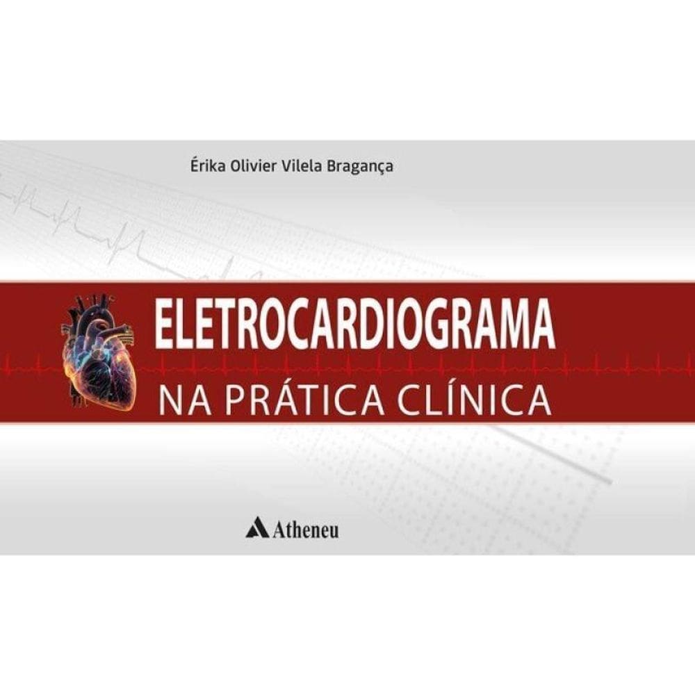 Eletrocardiograma Na Prática Clínica