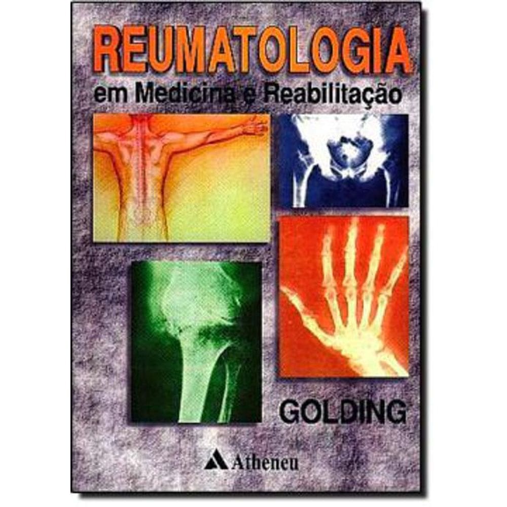 Livro Reumatologia Em Medicina E Reabilitação