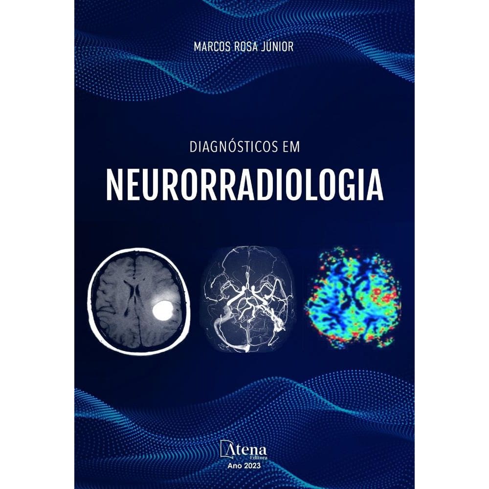 Diagnósticos em neurorradiologia