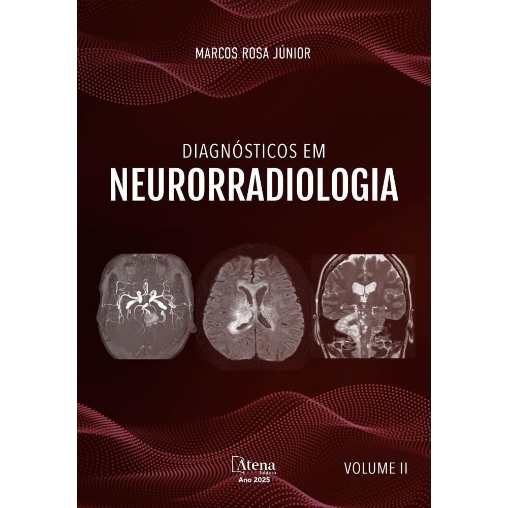 Diagnósticos em neurorradiologia - Volume II