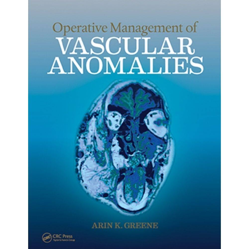 Operative Management Of Vascular Anomalies