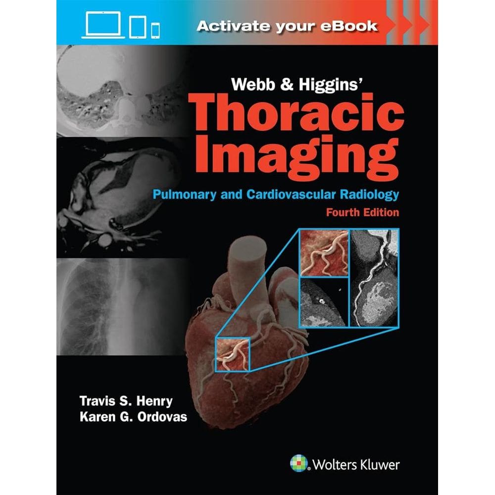 Webb And Higgins Thoracic Imaging