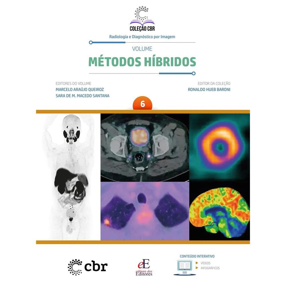 Coleção CBR Volume 6: Métodos Híbridos