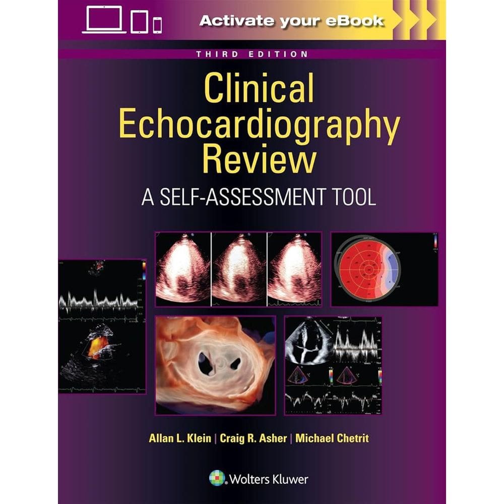 Clinical Echocardiography Review