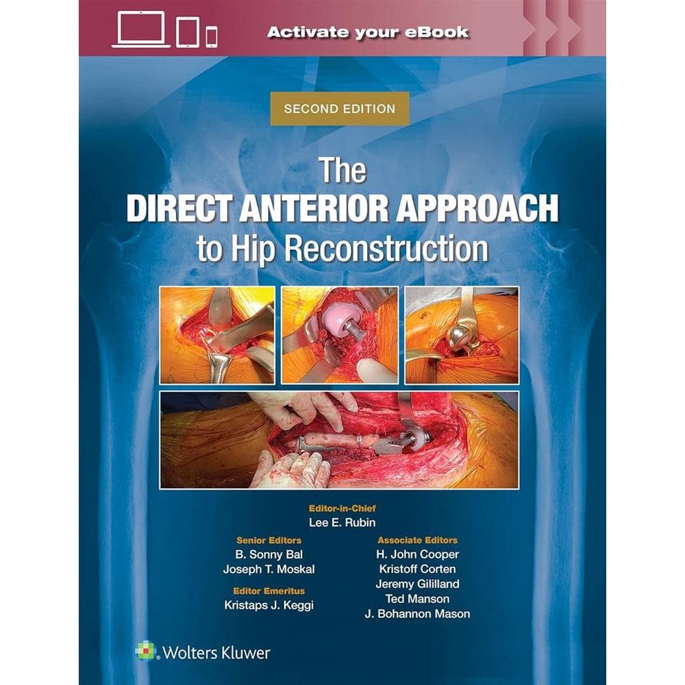 The Direct Anterior Approach To Hip Reconstruction