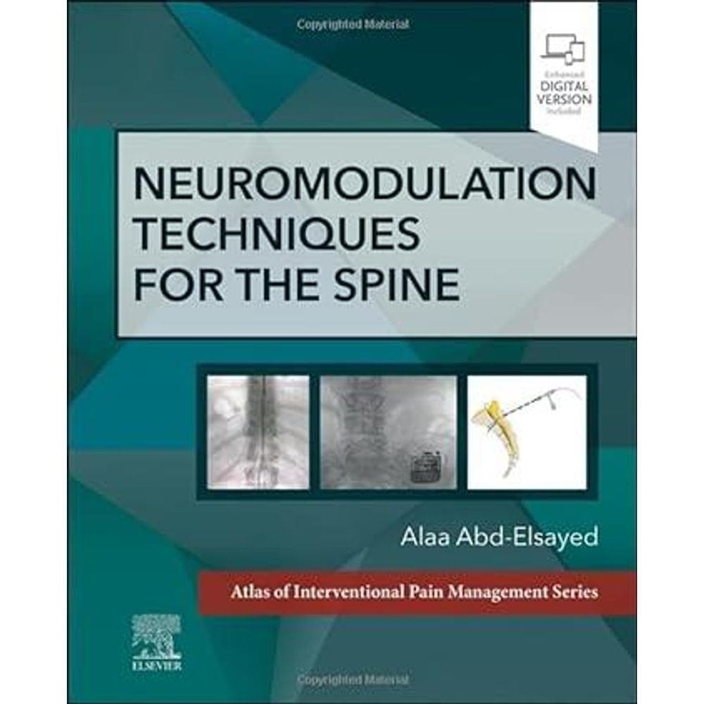 Neuromodulation Techniques For The Spine