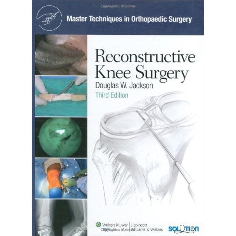 Master Techniques In Orthopaedic Surgery: Reconstructive Knee Surgery